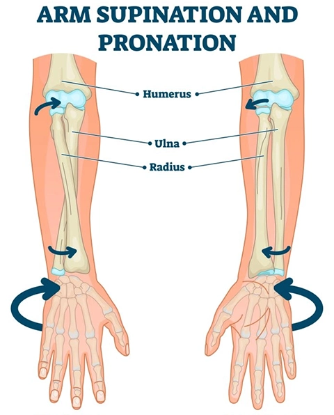Cannot Rotate Forearm After Wrist or Forearm Fracture — Rotational Malunion