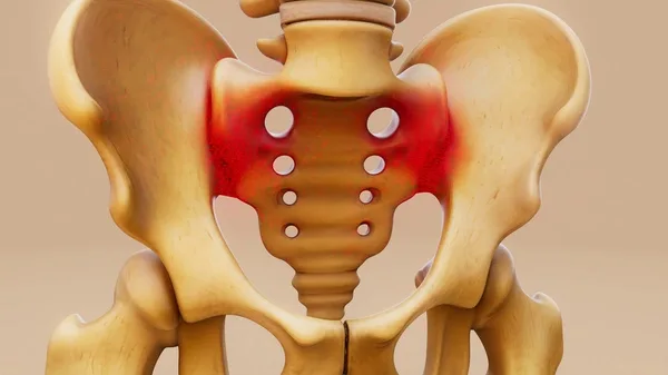 HIP Surgery